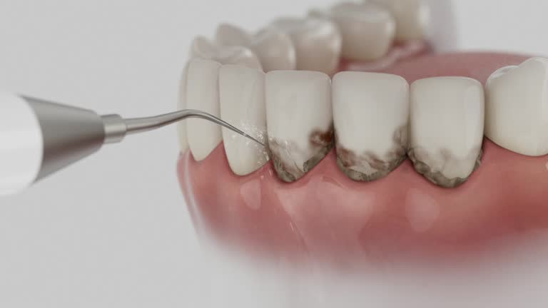 Trusted Teeth Cleaning And Checkup service in Atkins, AR - Dentist Open Now
